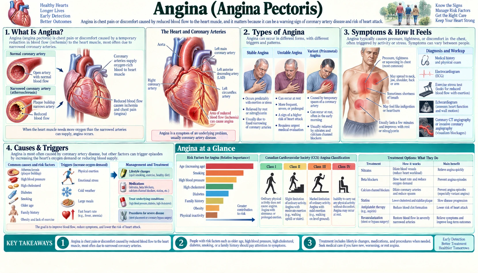 Angina — scientific infographic poster
