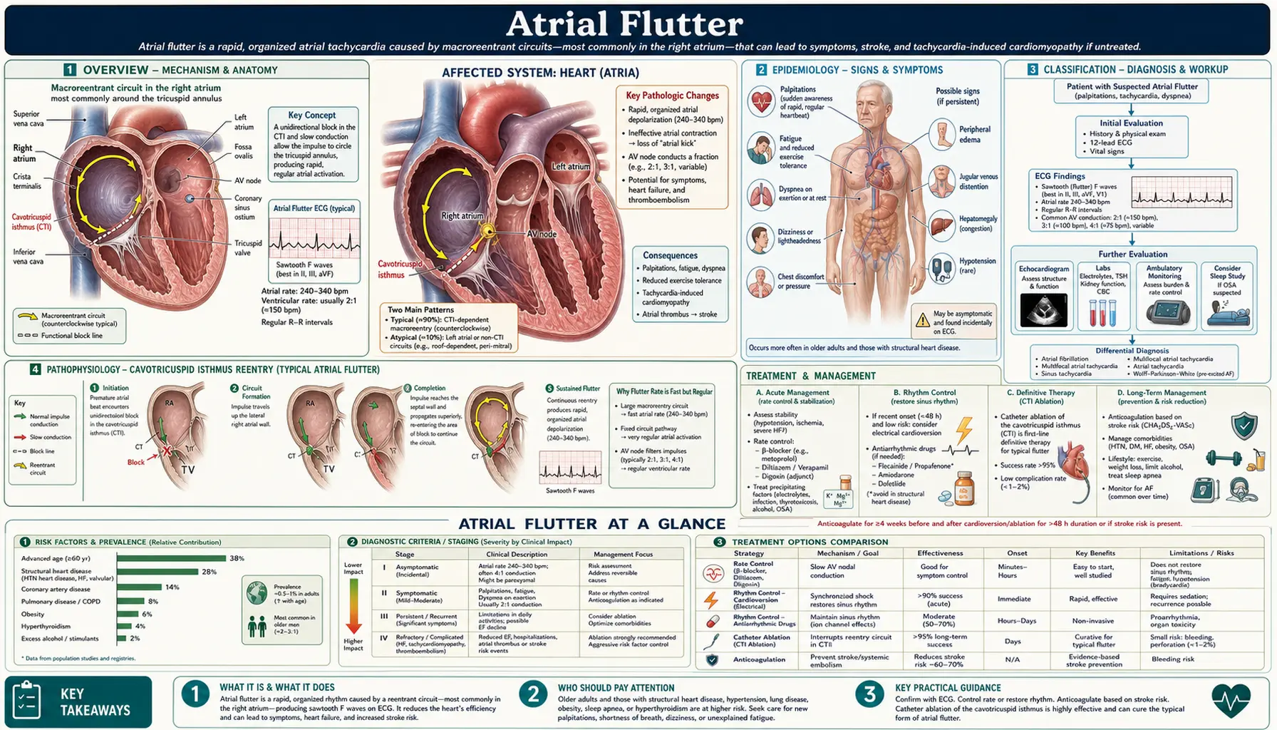 Atrial Flutter — scientific infographic poster