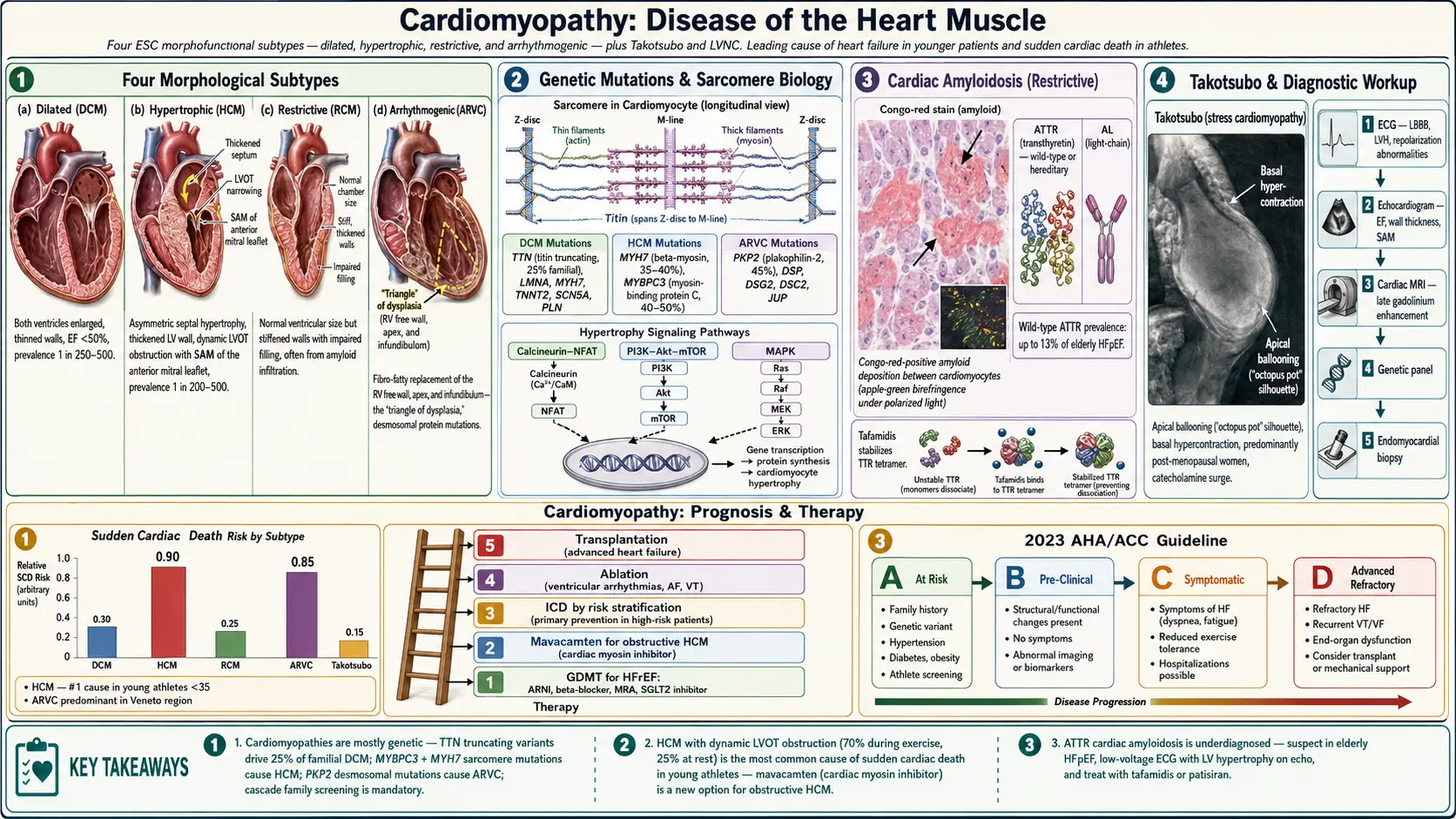 Cardiomyopathy — scientific infographic poster