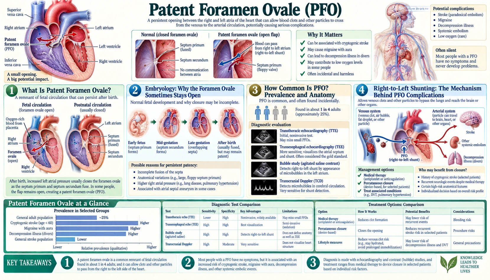 Patent Foramen Ovale — scientific infographic poster