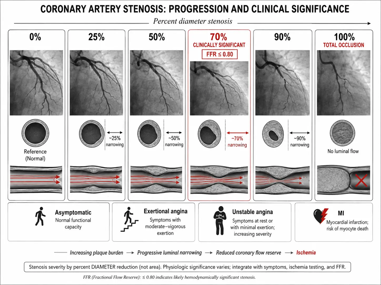Stenosis severity angiogram