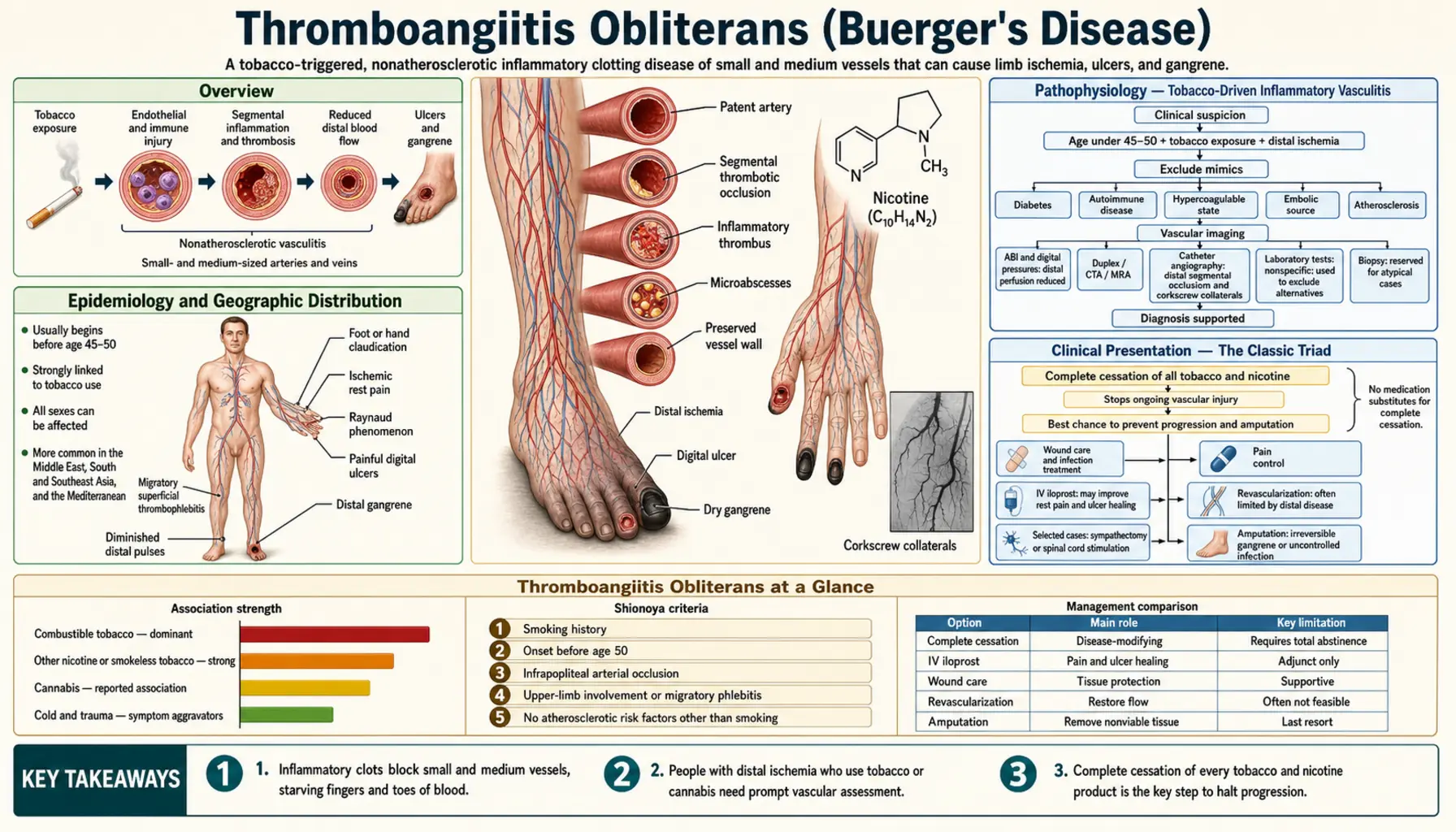 Thromboangiitis Obliterans — scientific infographic poster