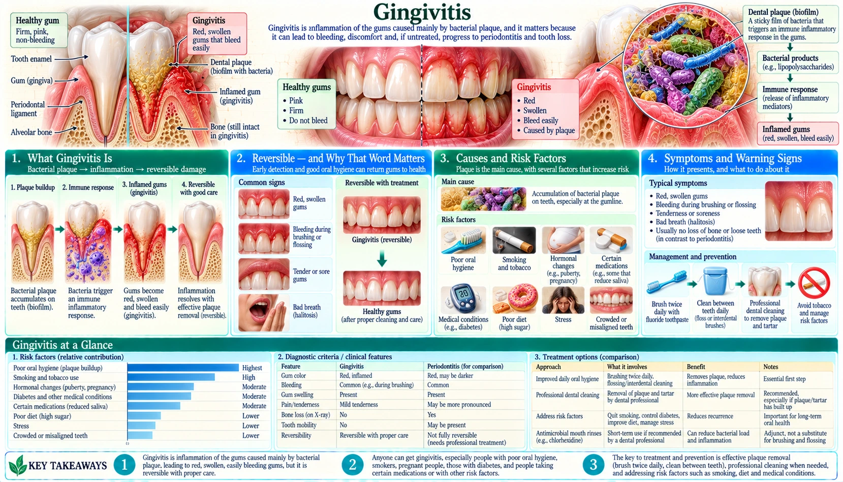 Gingivitis — scientific infographic poster