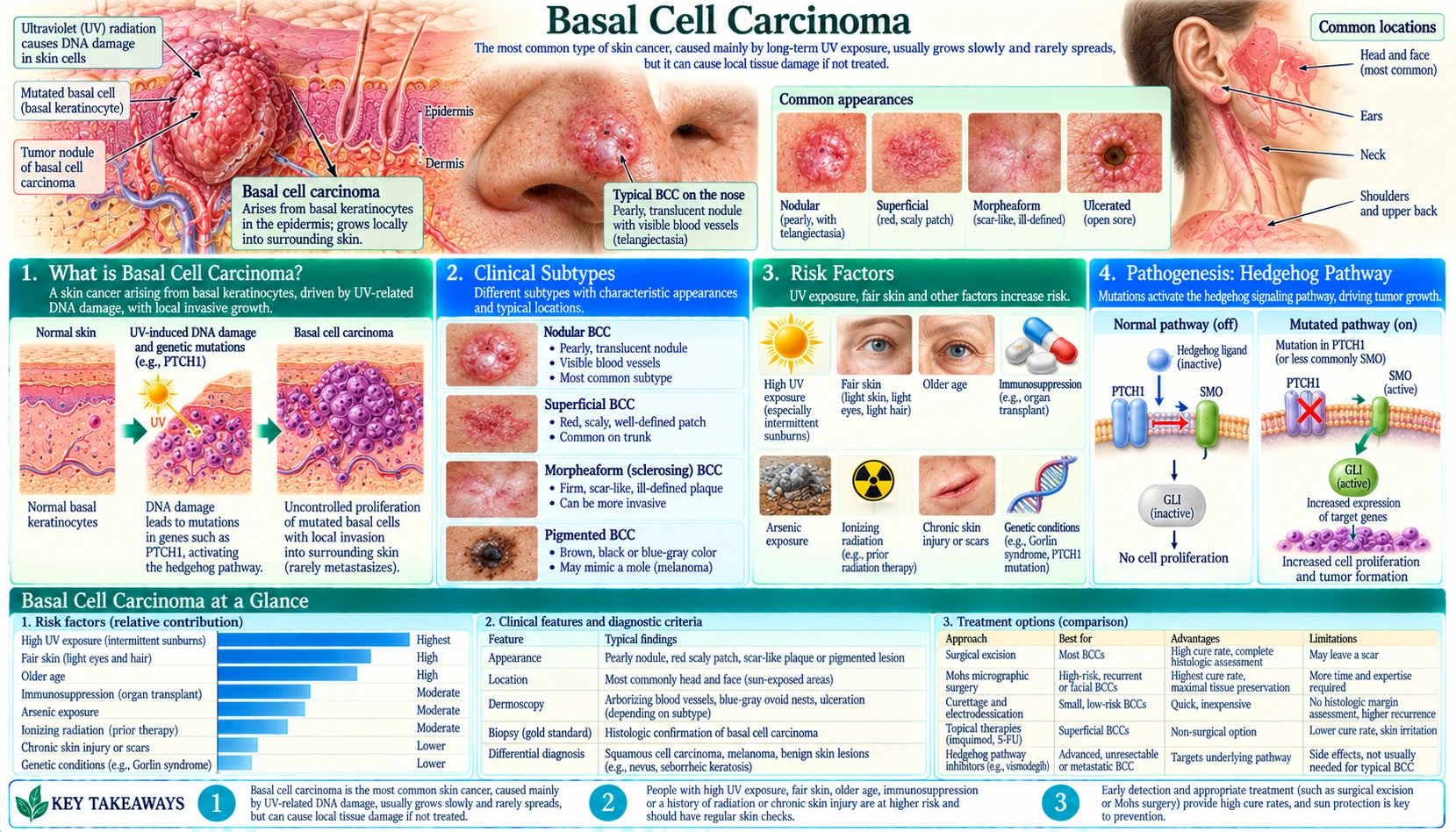 Basal Cell Carcinoma — scientific infographic poster