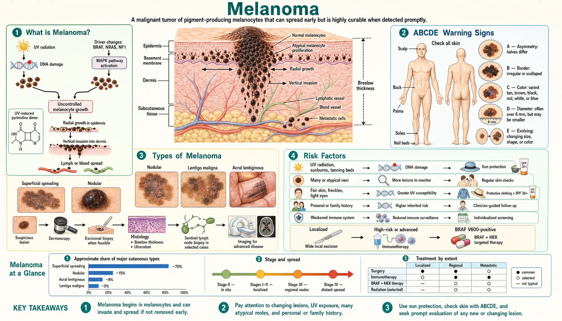 Melanoma — scientific infographic poster