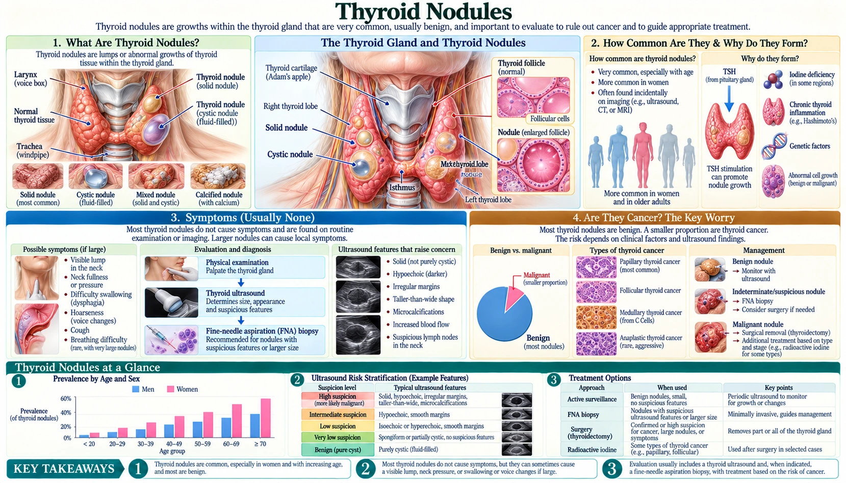 Thyroid Nodules — scientific infographic poster