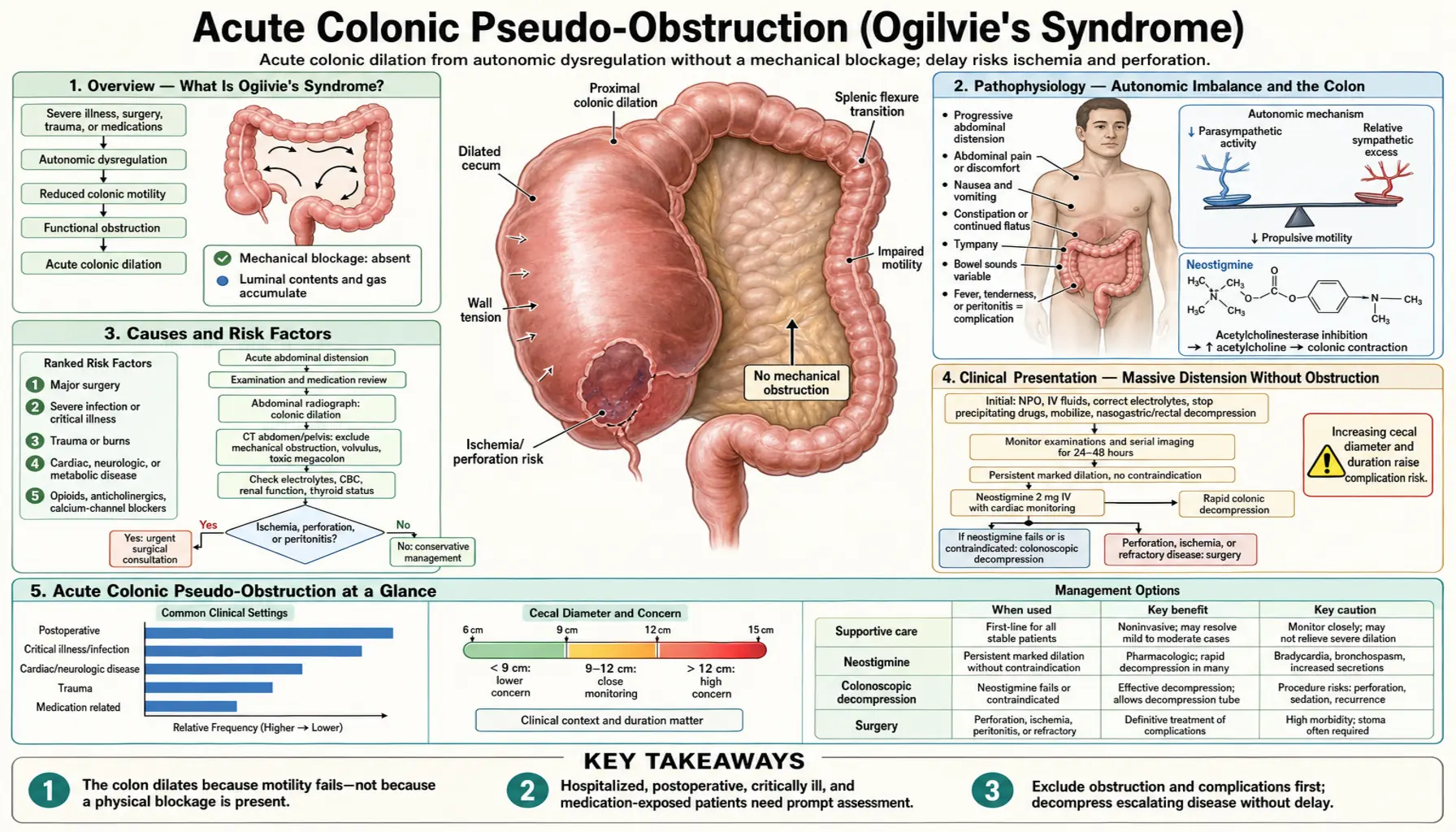 Acute Colonic Pseudo Obstruction — scientific infographic poster