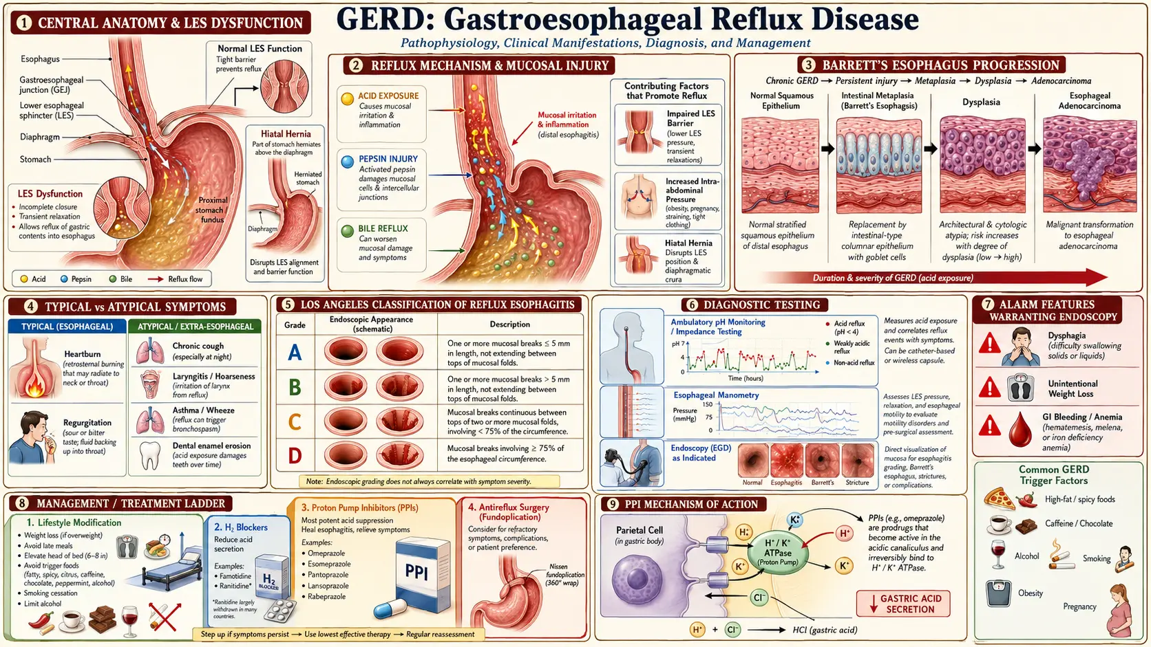 Gastroesophageal Reflux Disease — scientific infographic poster