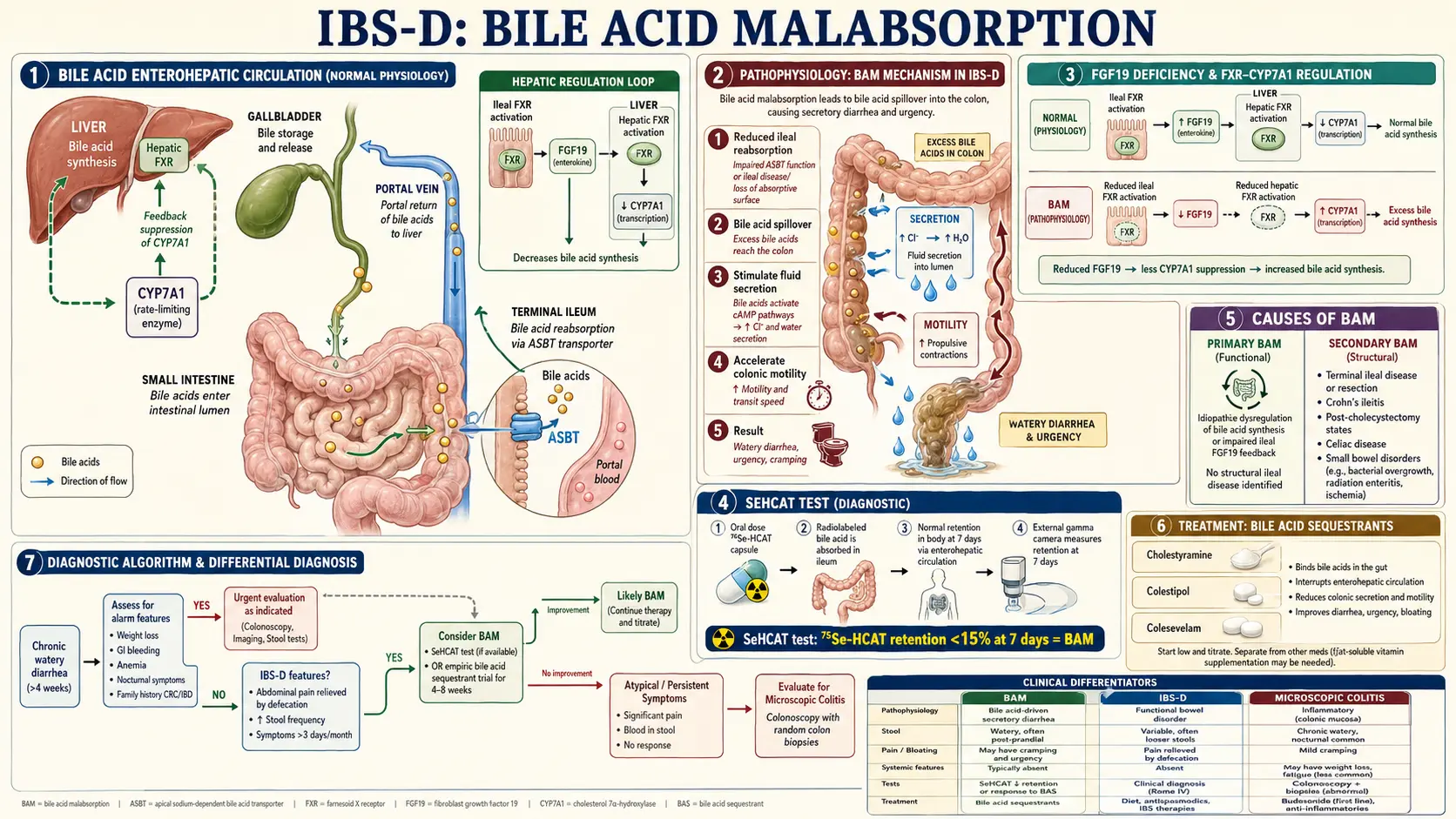 Bile Acid Malabsorption in IBS D — scientific infographic poster