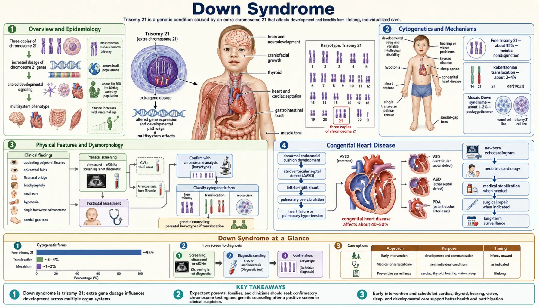 Down Syndrome — scientific infographic poster