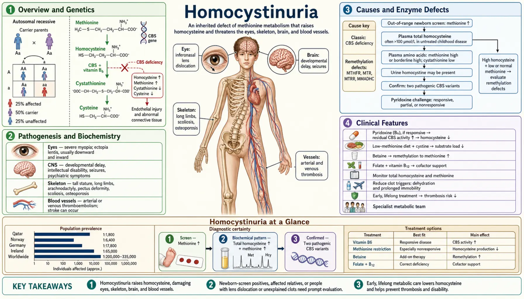 Homocystinuria — scientific infographic poster