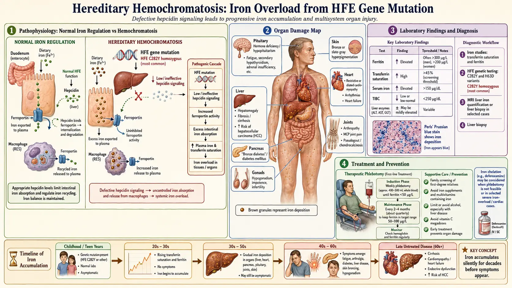 Hemochromatosis — scientific infographic poster