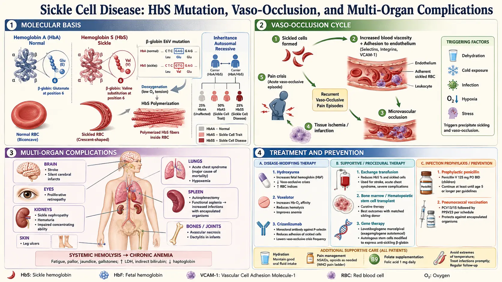 Sickle Cell Disease — scientific infographic poster