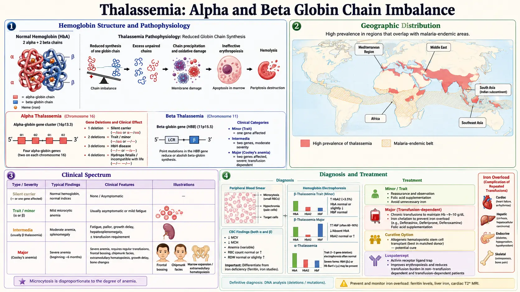 Thalassemia — scientific infographic poster