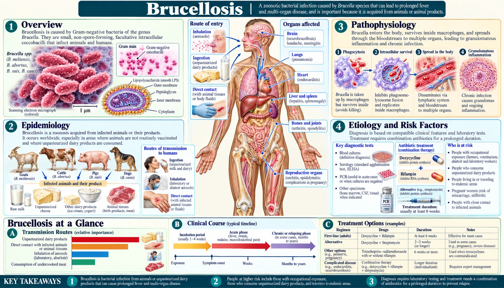 Brucellosis — scientific infographic poster