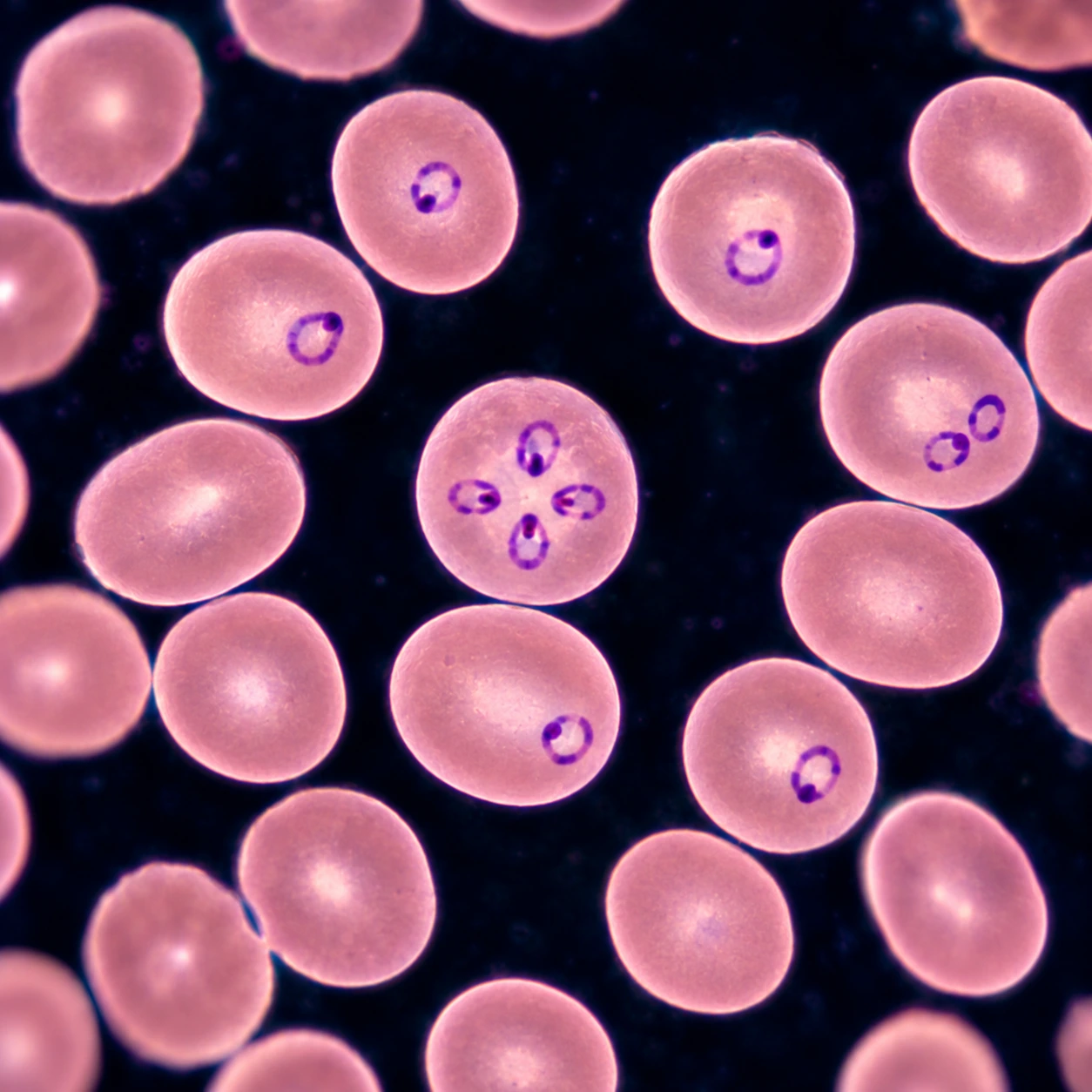 Blood smear with ring-shaped parasites inside red cells