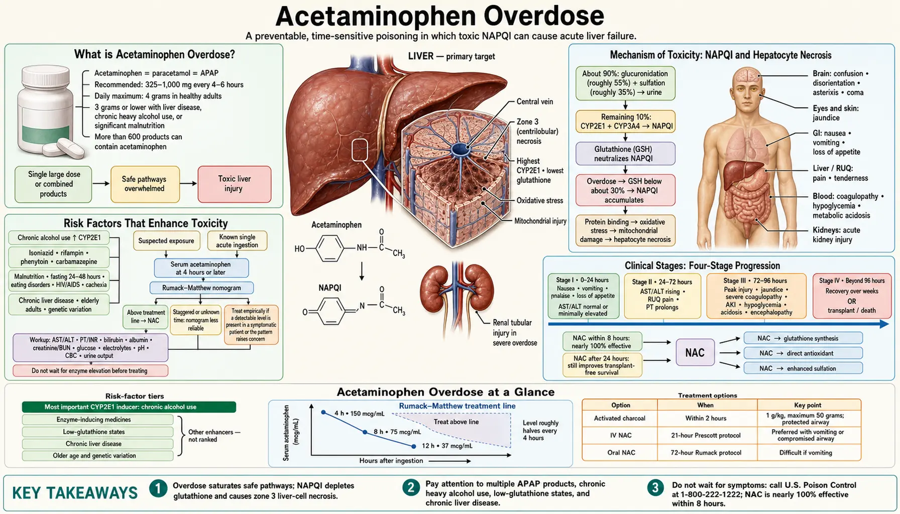 Acetaminophen Overdose — scientific infographic poster
