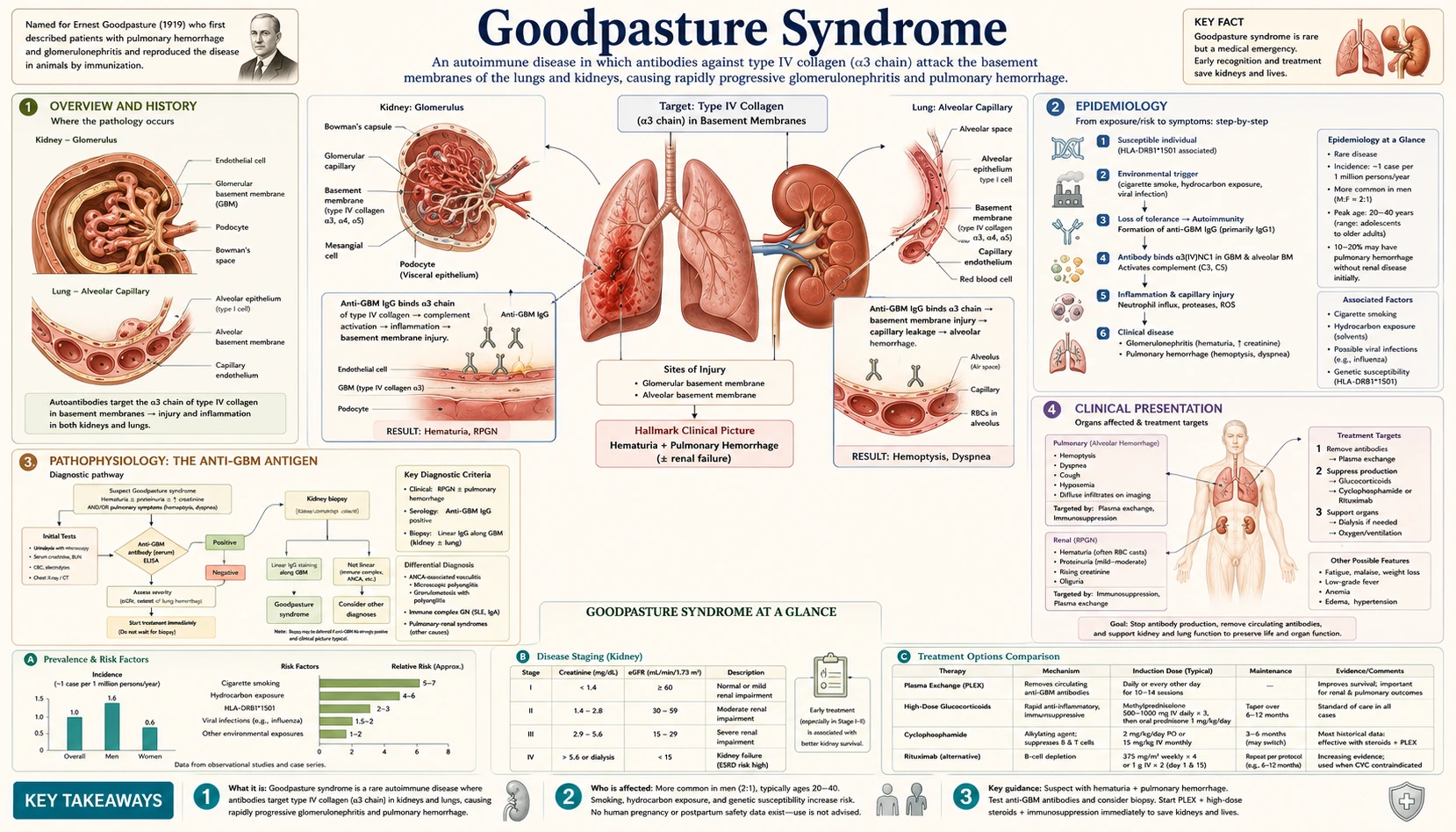 Goodpasture Syndrome — scientific infographic poster