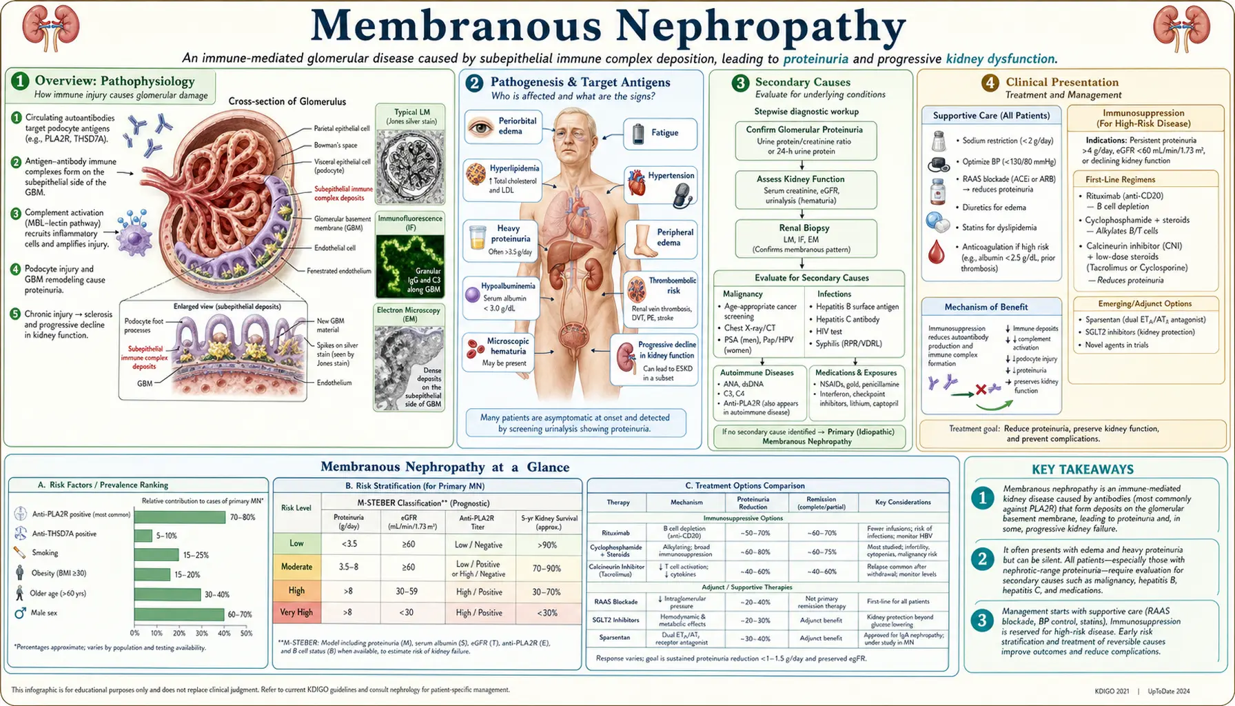 Membranous Nephropathy — scientific infographic poster