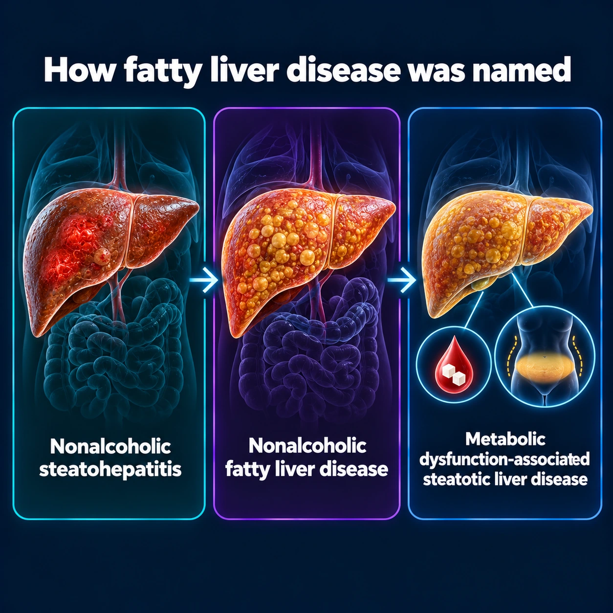Infographic: the three names of fatty liver disease