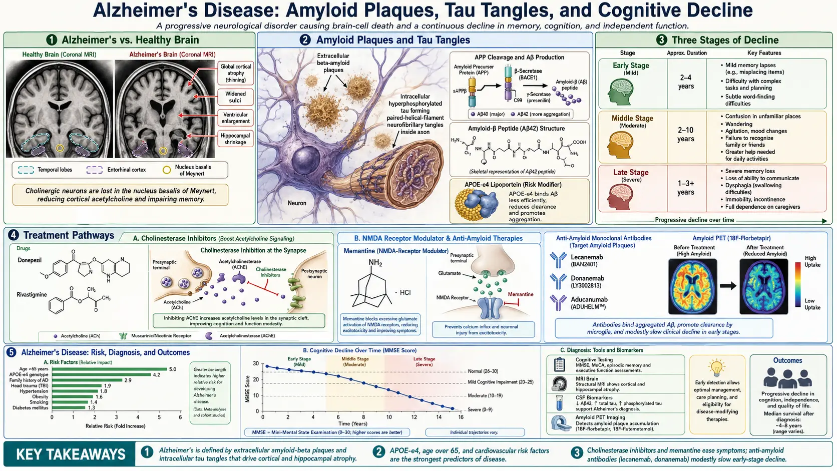 Alzheimers Disease — scientific infographic poster