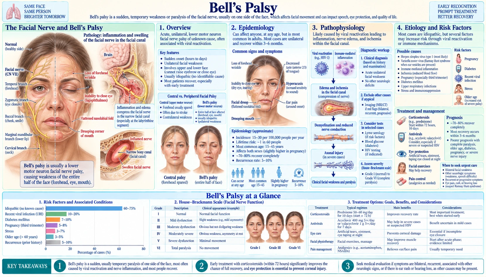 Bells Palsy — scientific infographic poster