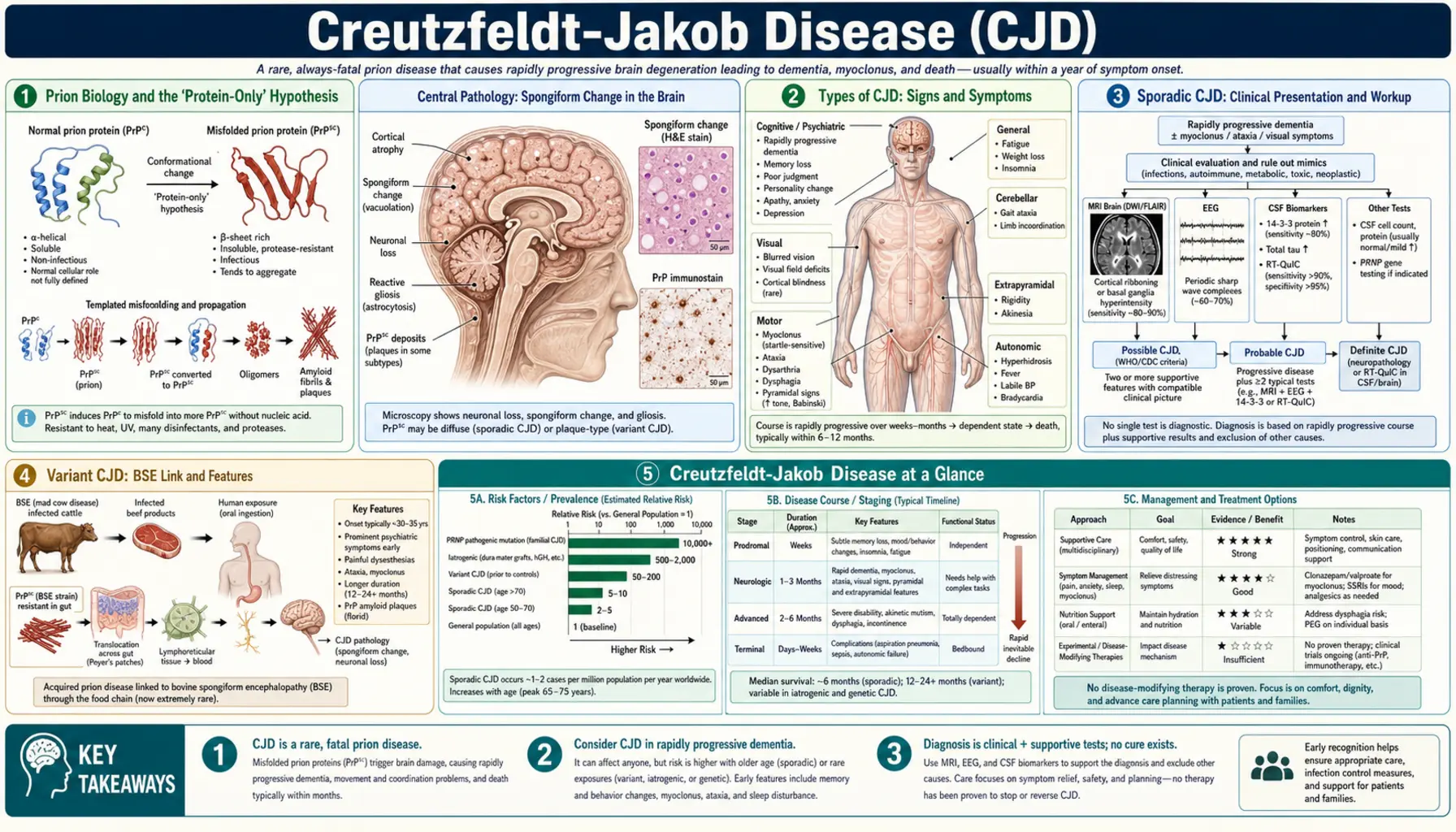 Creutzfeldt Jakob Disease — scientific infographic poster