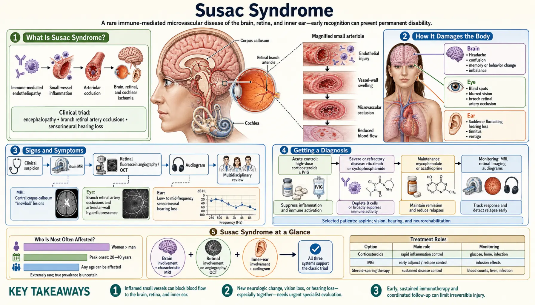 Susac Syndrome — scientific infographic poster