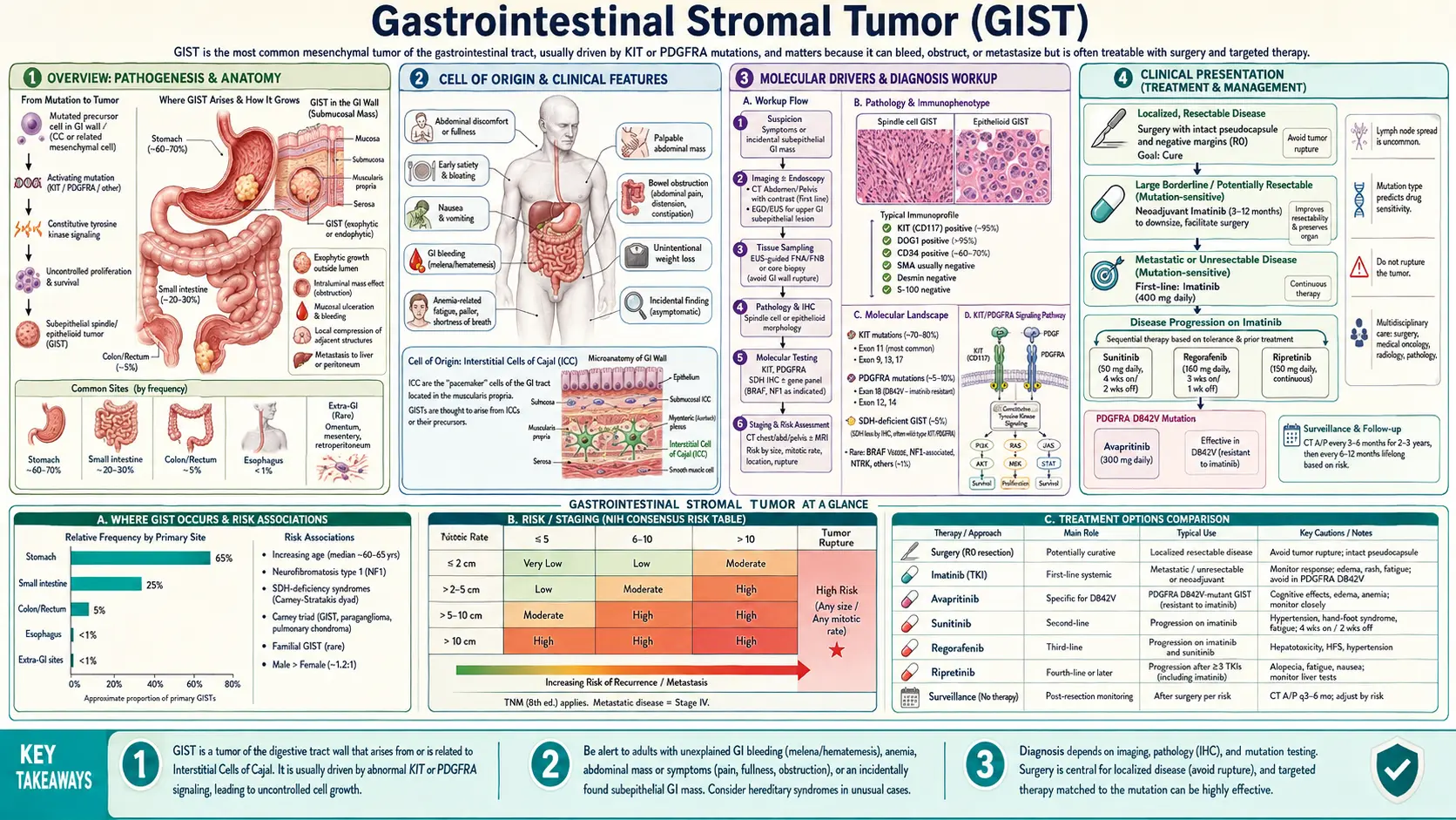 Gastrointestinal Stromal Tumor — scientific infographic poster