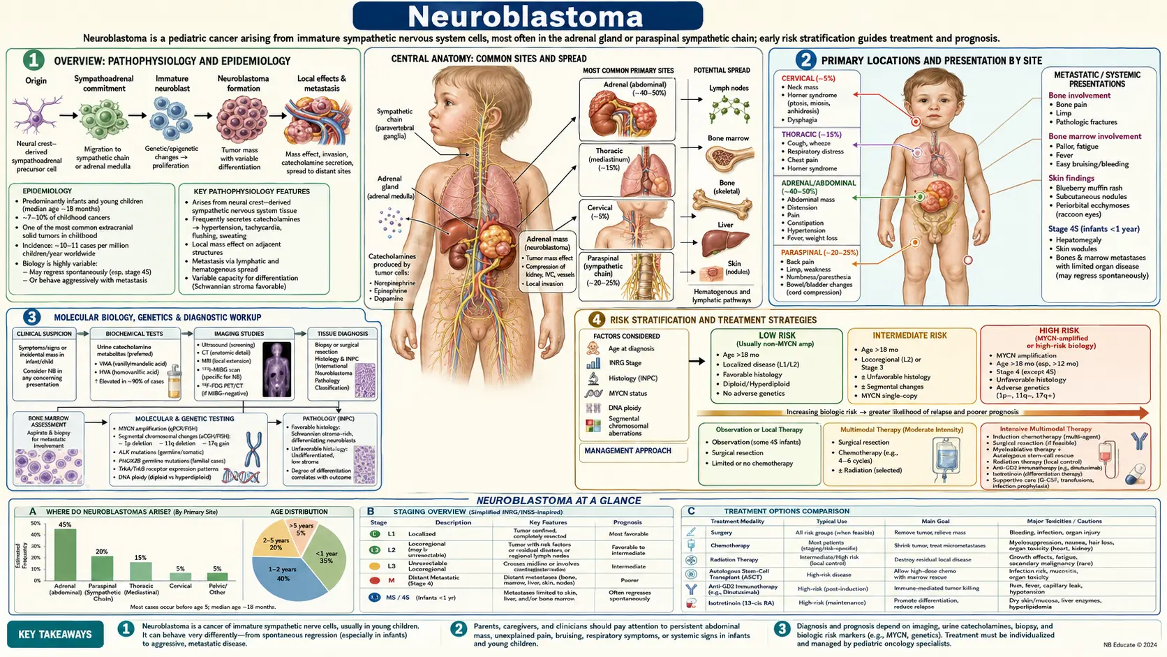 Neuroblastoma — scientific infographic poster