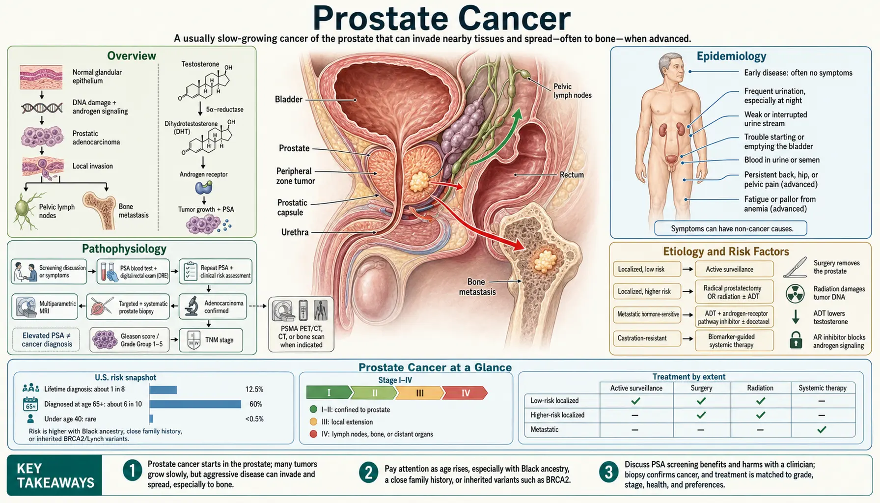 Prostate Cancer — scientific infographic poster