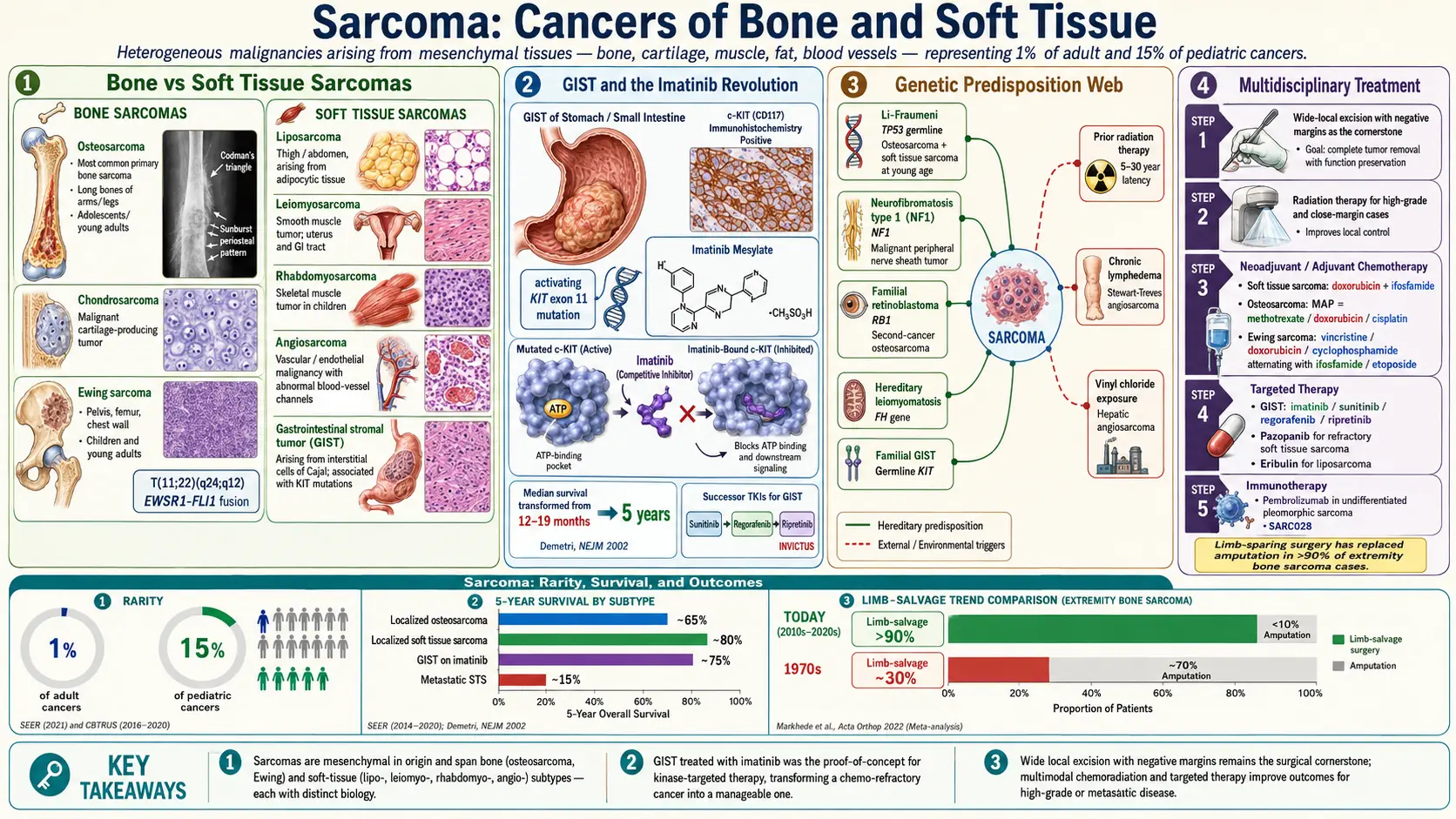 Sarcoma — scientific infographic poster