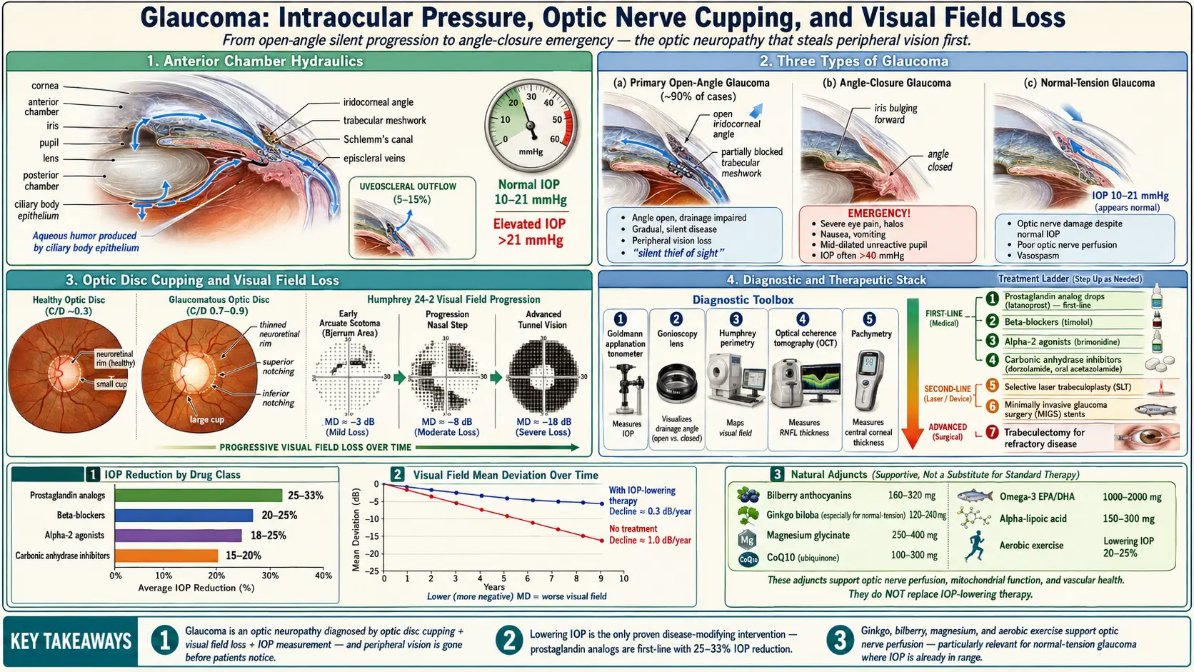 Glaucoma — scientific infographic poster