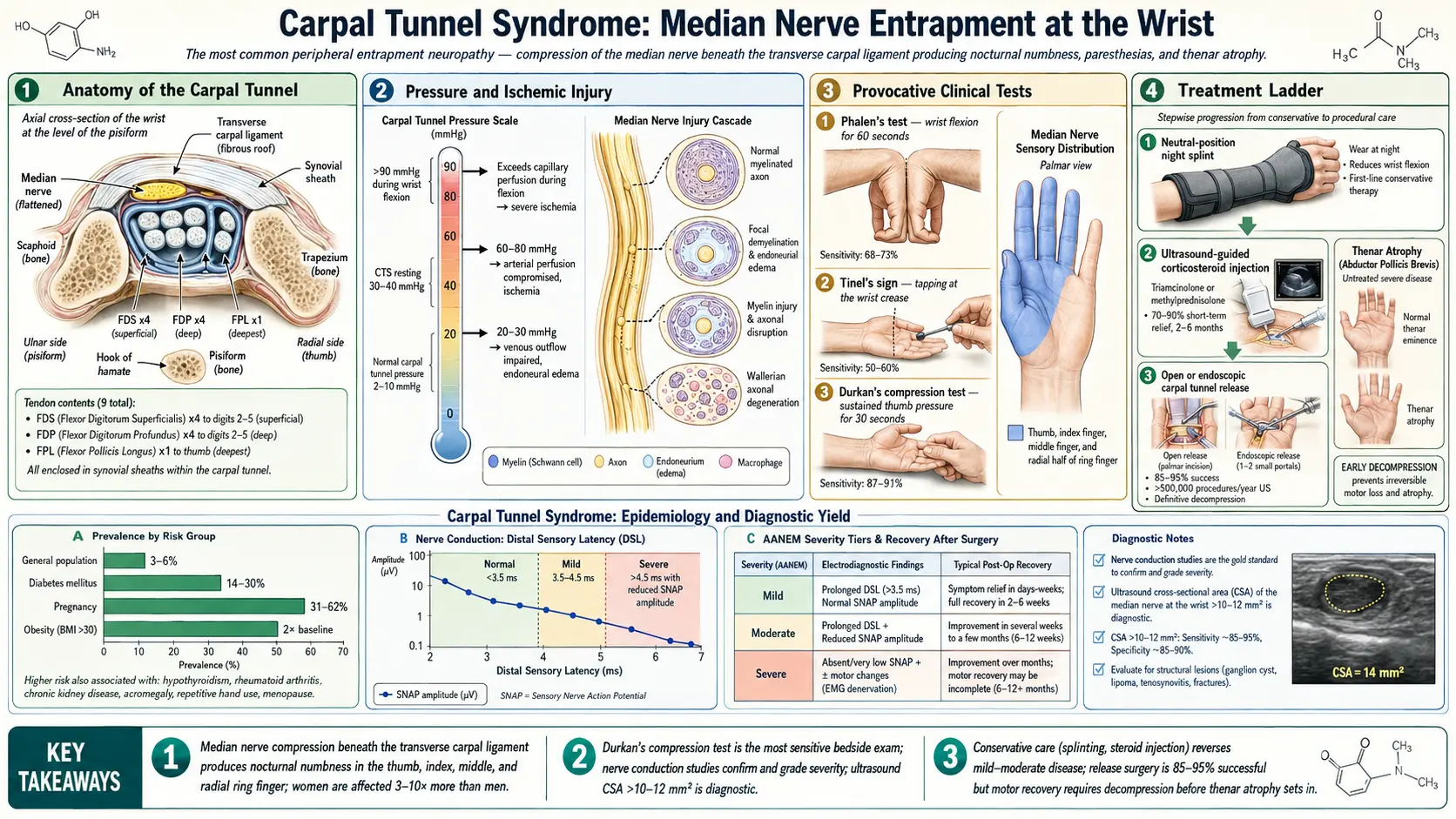 Carpal Tunnel Syndrome — scientific infographic poster