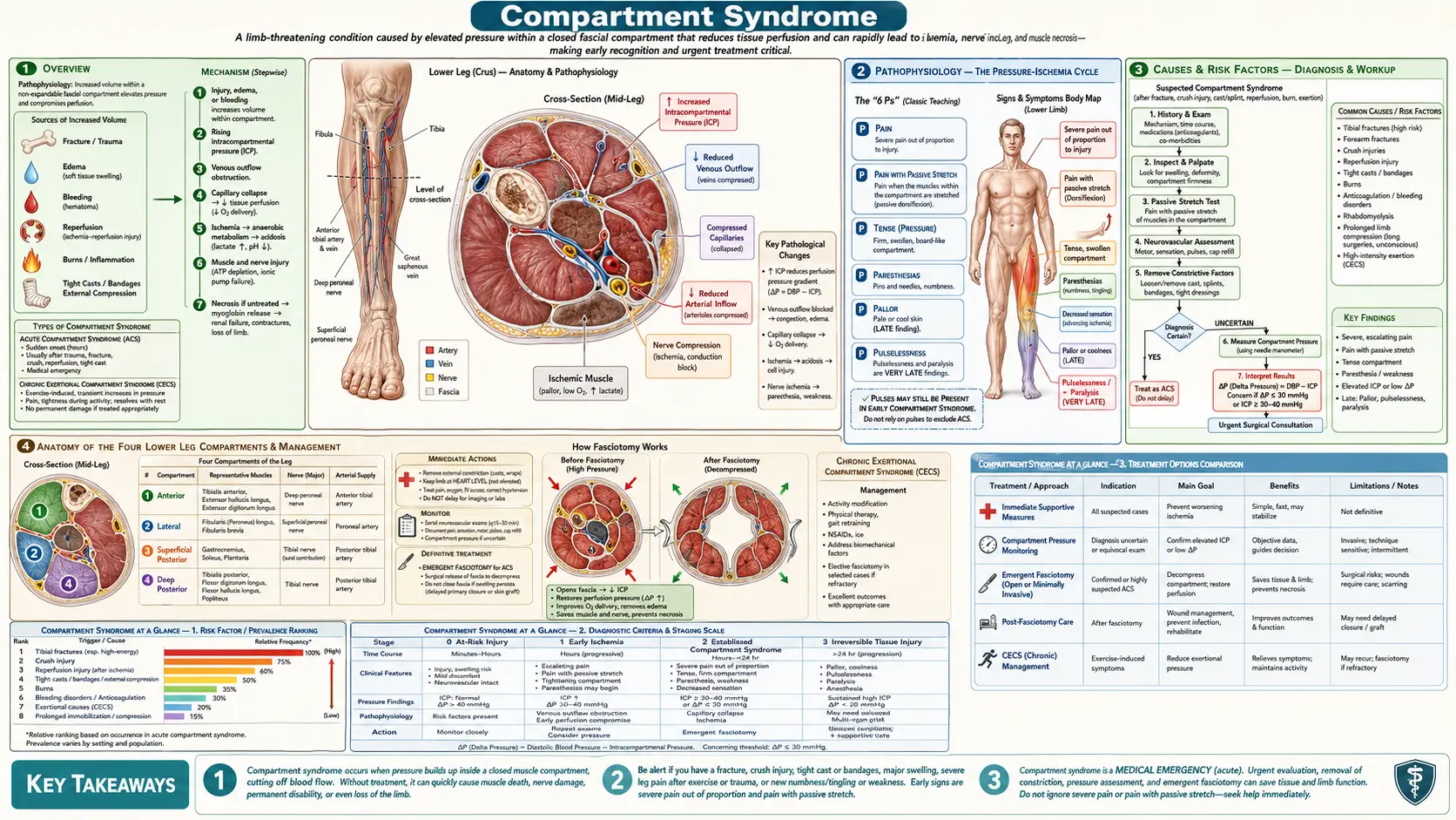 Compartment Syndrome — scientific infographic poster