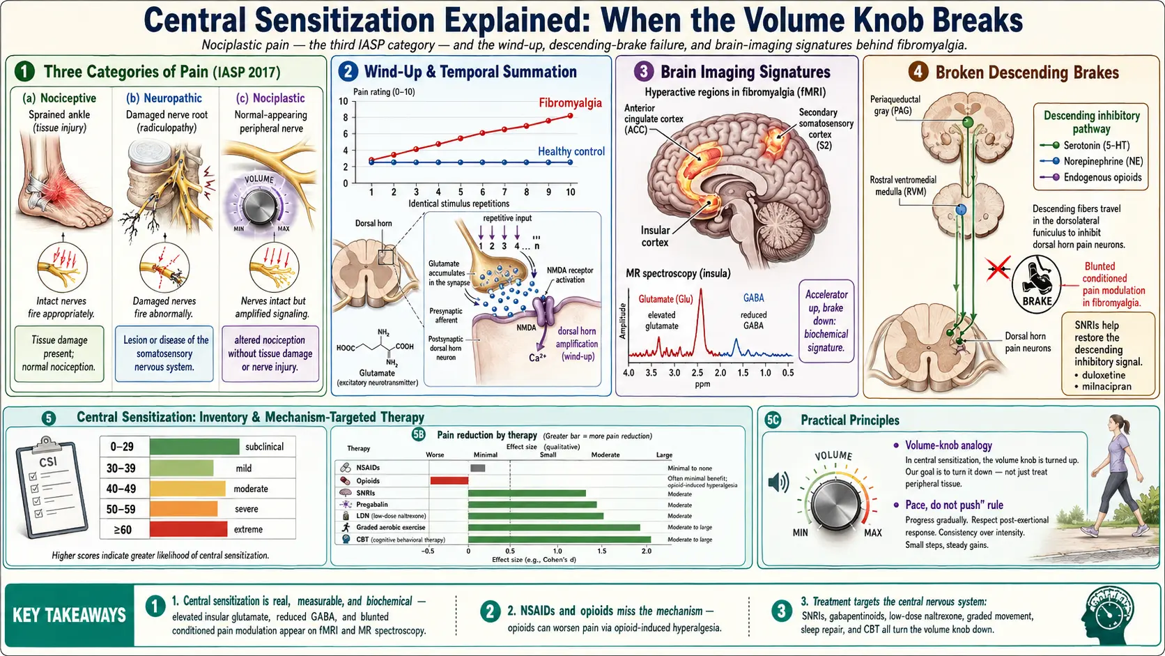 Central Sensitization Explained — scientific infographic poster