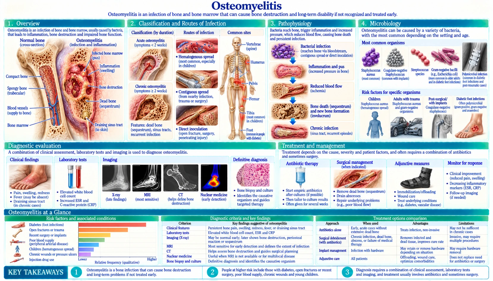 Osteomyelitis — scientific infographic poster