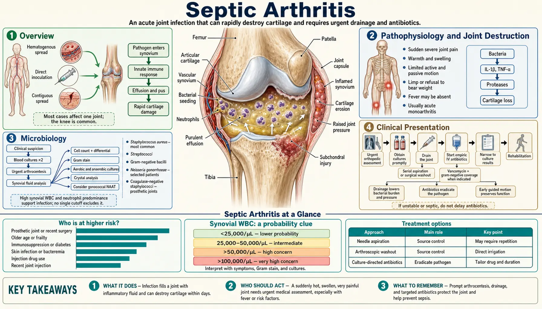 Septic Arthritis — scientific infographic poster