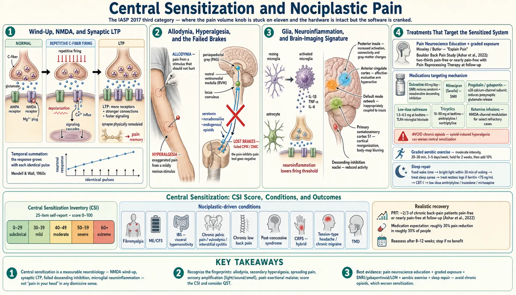 Central Sensitization and Nociplastic Pain — scientific infographic poster
