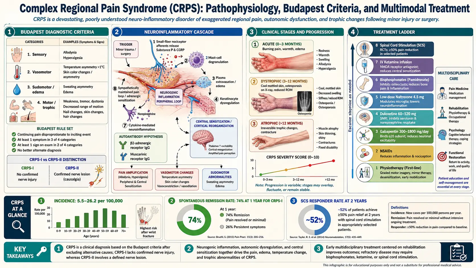 Complex Regional Pain Syndrome — scientific infographic poster