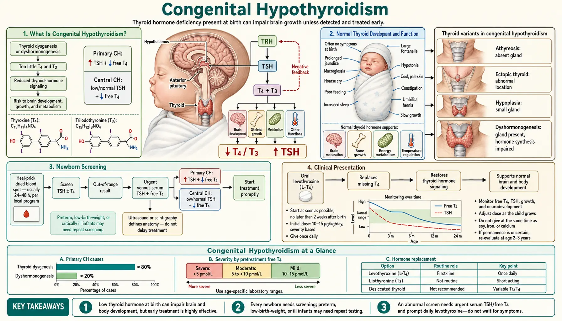 Congenital Hypothyroidism — scientific infographic poster