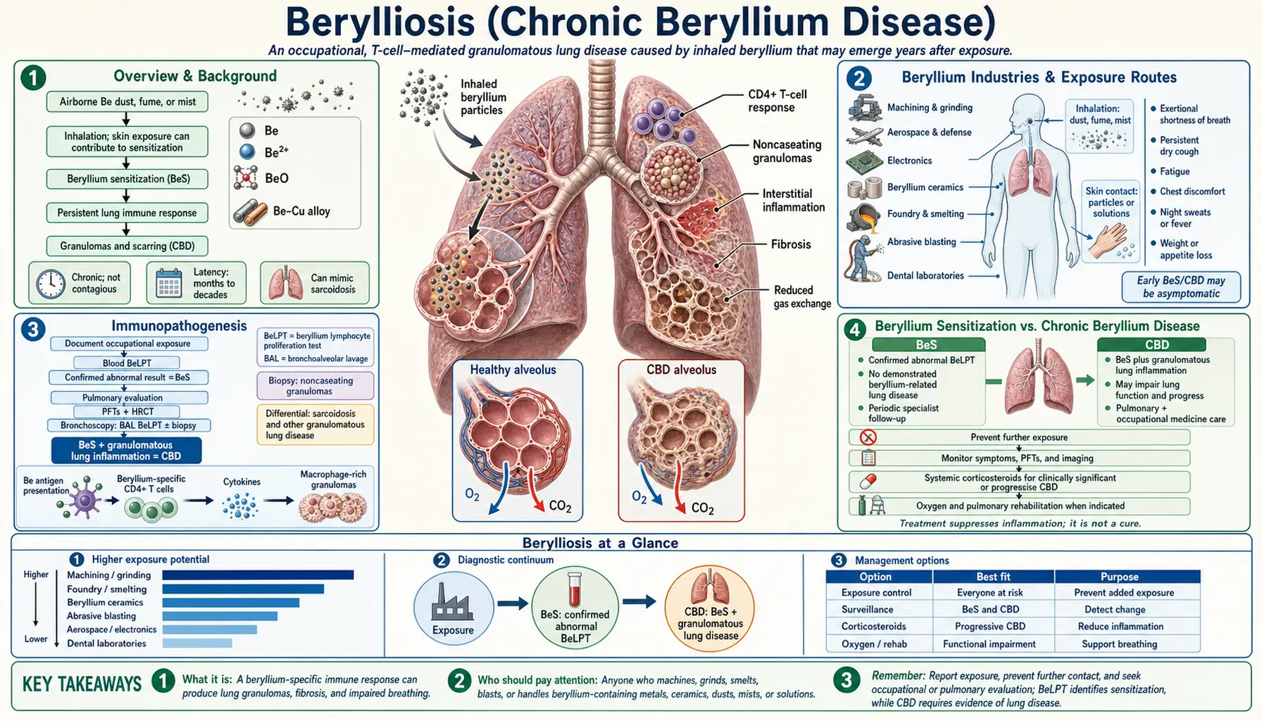 Berylliosis — scientific infographic poster