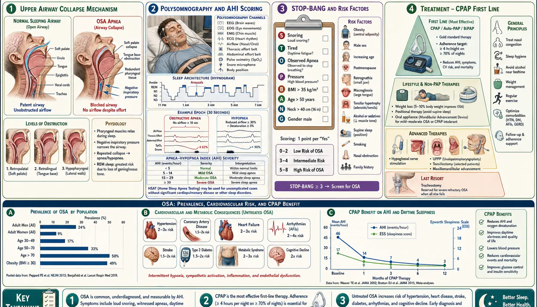 Obstructive Sleep Apnea — scientific infographic poster