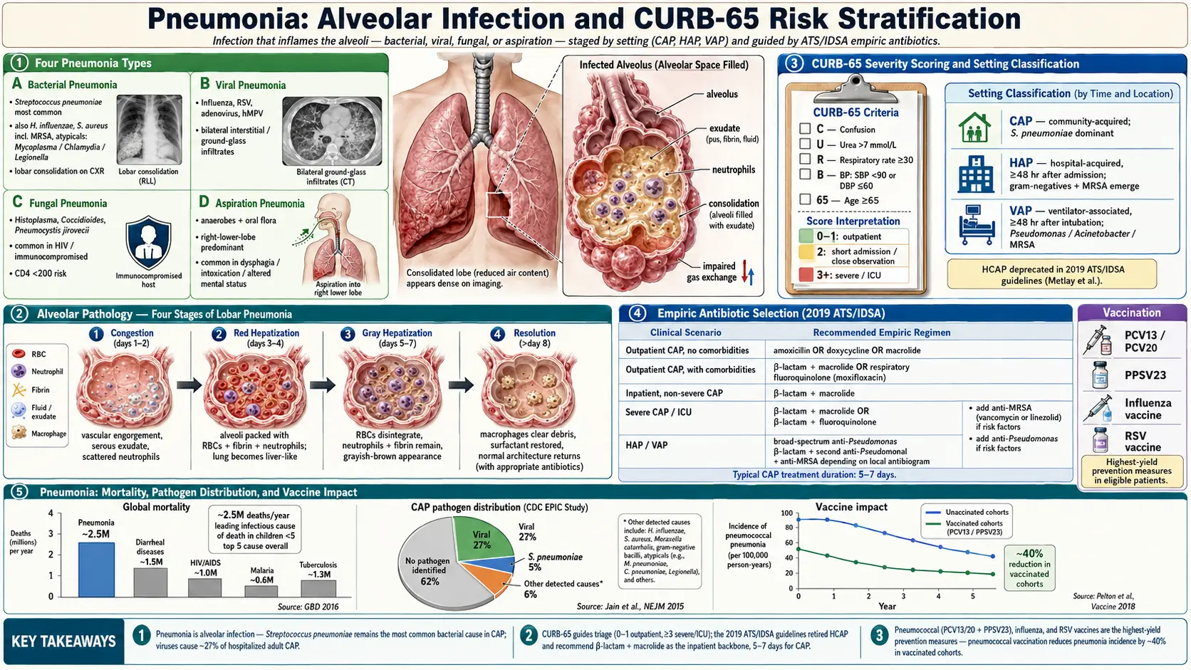 Pneumonia — scientific infographic poster