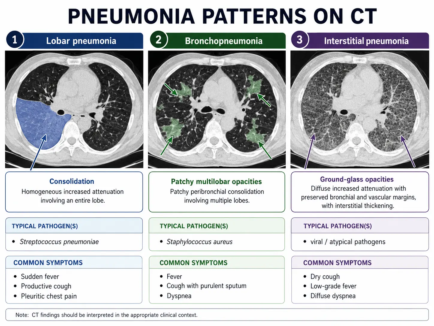 Pneumonia types comparison
