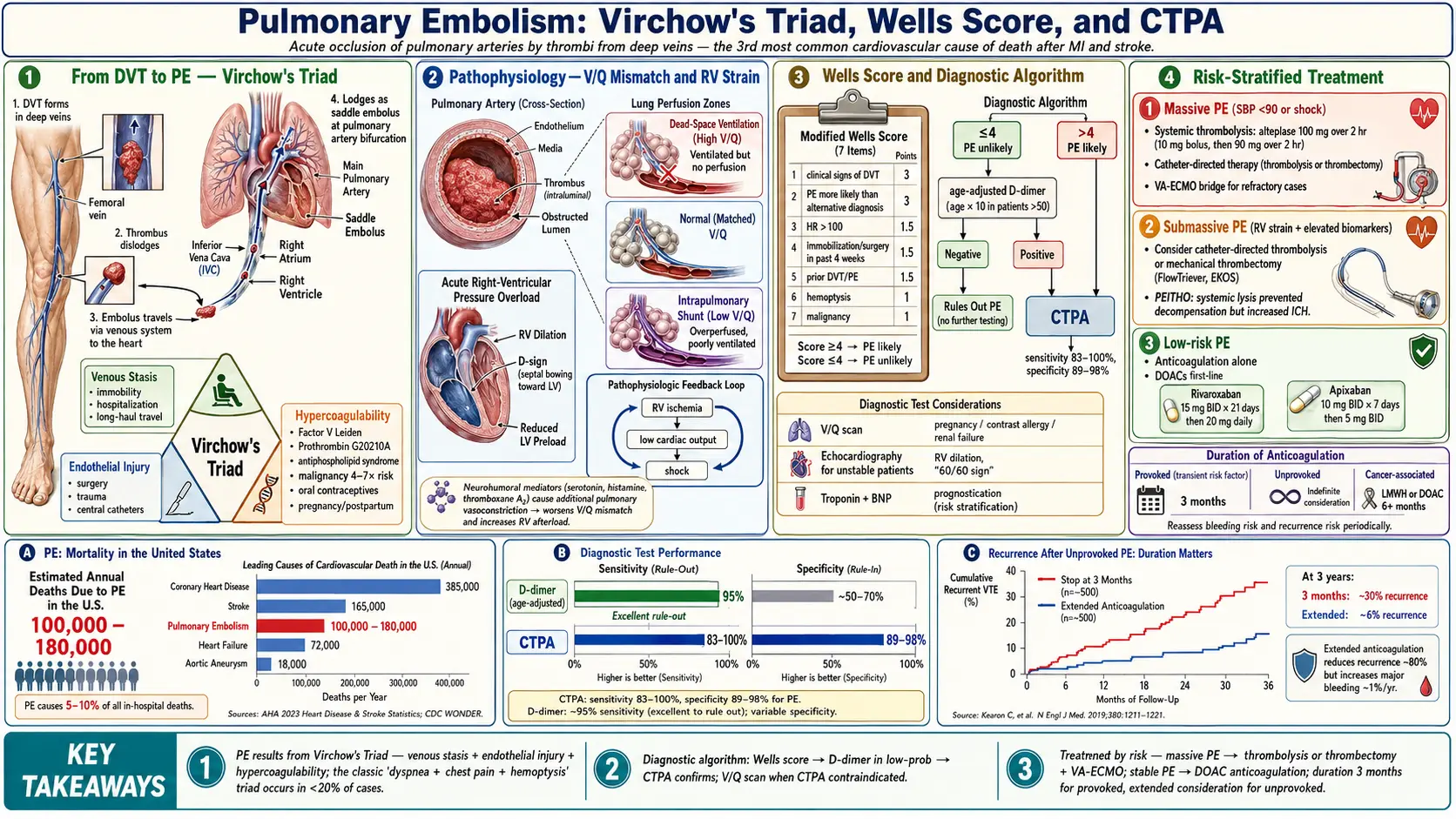 Pulmonary Embolism — scientific infographic poster