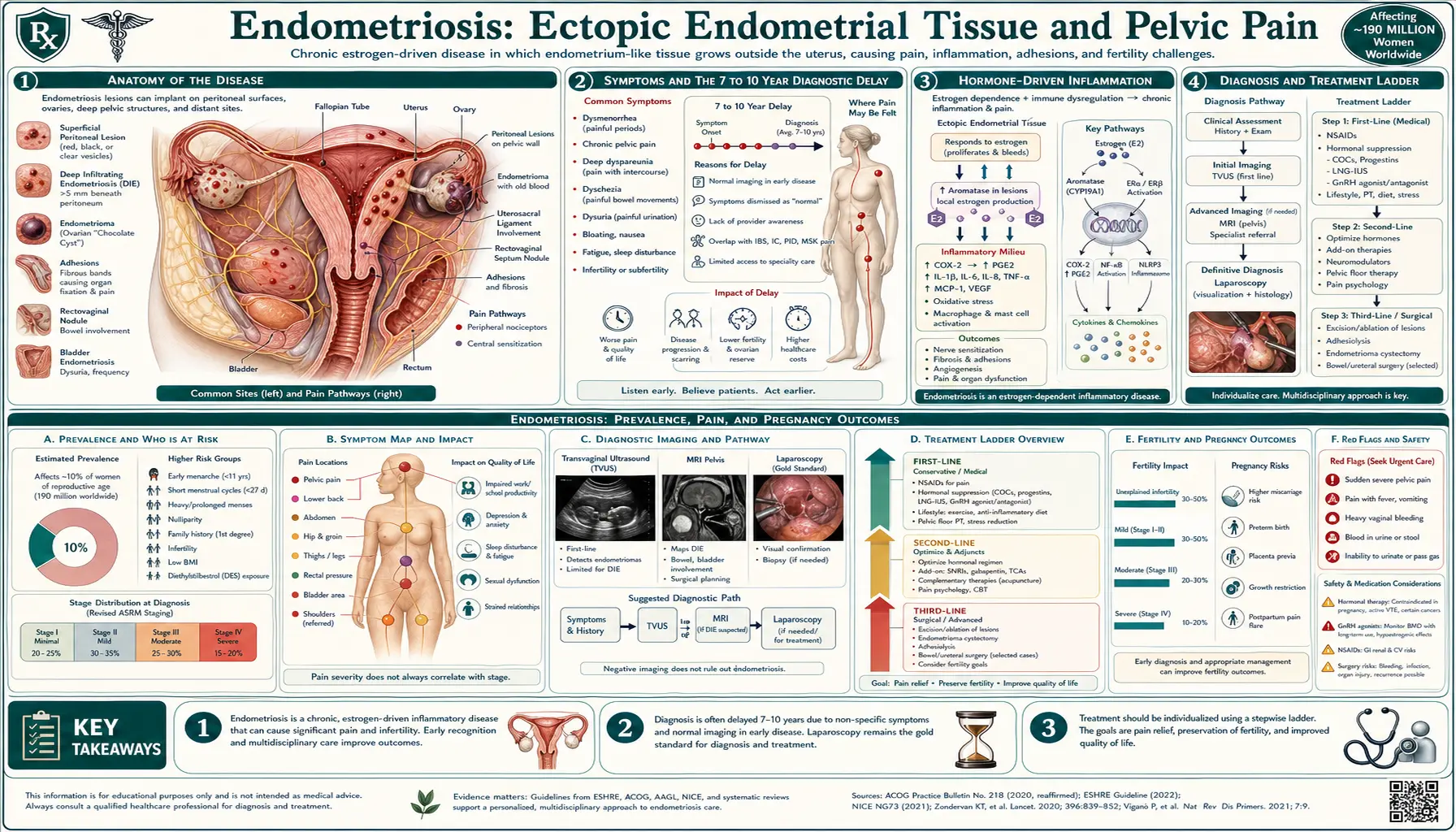 Endometriosis — scientific infographic poster
