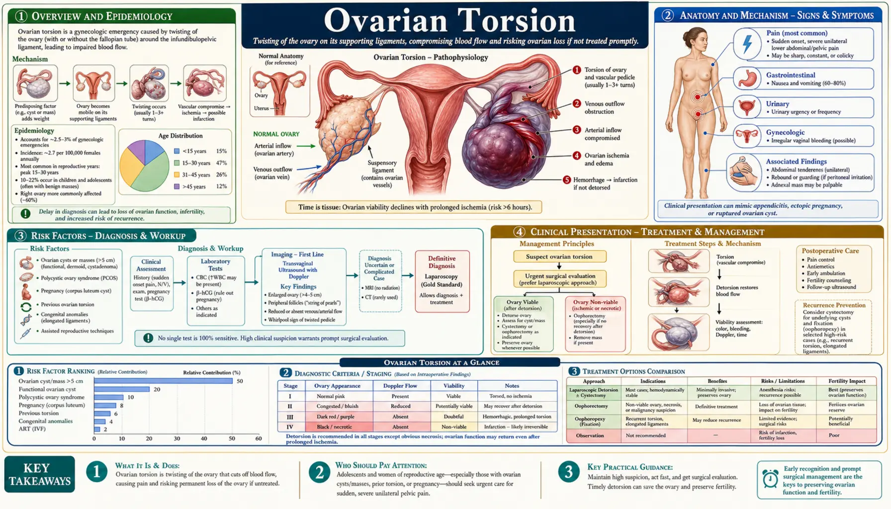 Ovarian Torsion — scientific infographic poster