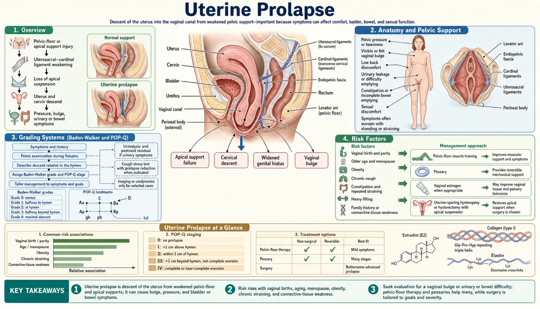 Uterine Prolapse — scientific infographic poster