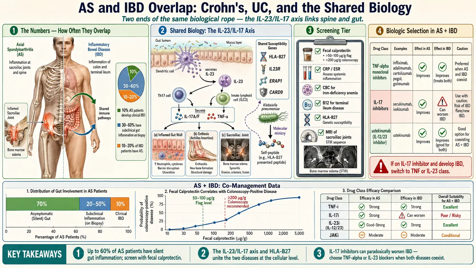 AS and IBD Overlap — scientific infographic poster